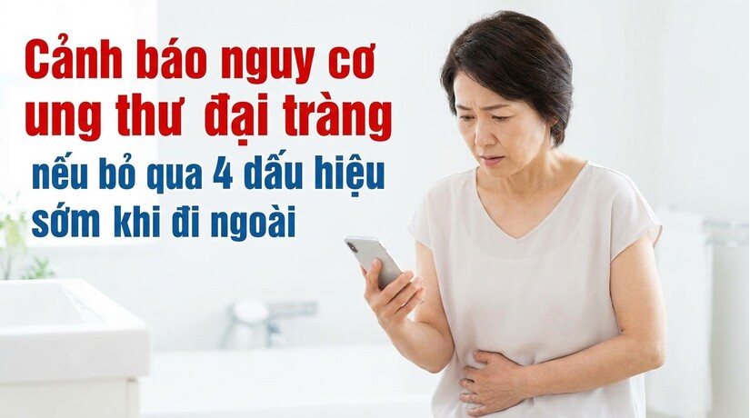 Cảnh báo nguy cơ ung thư đại tràng nếu bỏ qua 4 dấu hiệu khi đi ngoài