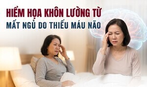 Hiểm họa khôn lường từ mất ngủ do thiếu máu não