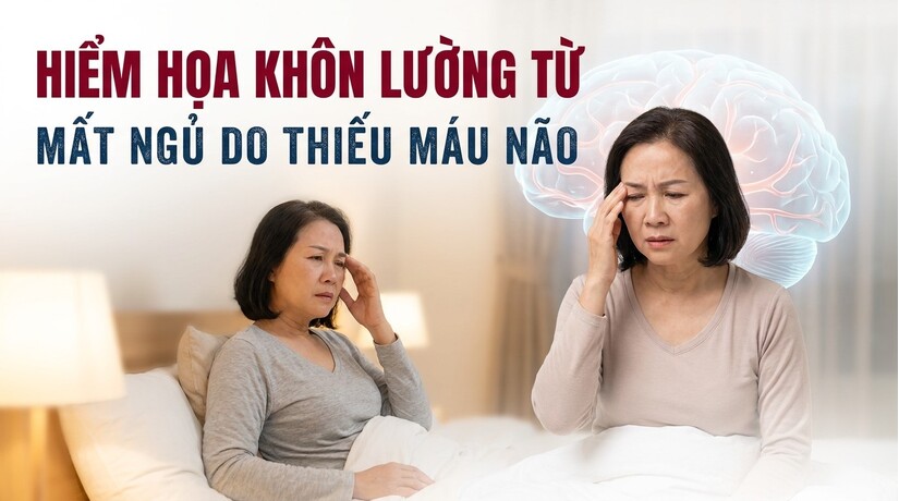 Hiểm họa khôn lường từ mất ngủ do thiếu máu não