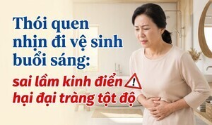 Thói quen nhịn đi vệ sinh buổi sáng: sai lầm kinh điển hại đại tràng