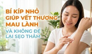Bí kíp nhỏ giúp vết thương mau lành và không để lại sẹo thâm