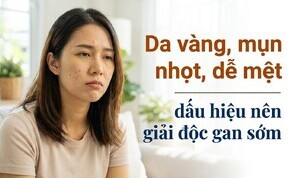Da vàng, mụn nhọt, dễ mệt - dấu hiệu nên giải độc gan sớm