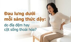 Đau lưng dưới mỗi sáng thức dậy: do đĩa đệm hay cột sống thoái hóa?