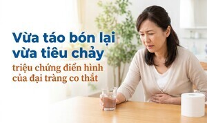Vừa táo bón lại vừa tiêu chảy - triệu chứng của đại tràng co thắt
