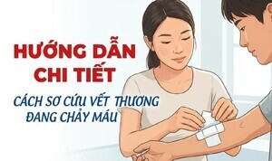 Hướng dẫn chi tiết cách sơ cứu vết thương đang chảy máu