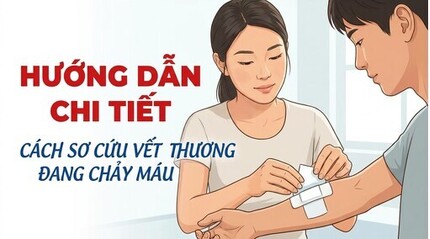 Hướng dẫn chi tiết cách sơ cứu vết thương đang chảy máu