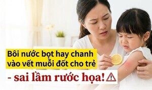 Bôi nước bọt hay chanh vào vết muỗi đốt cho trẻ - sai lầm rước họa!