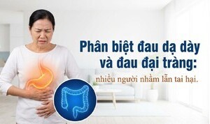 Phân biệt đau dạ dày và đau đại tràng: nhiều người nhầm lẫn tai hại