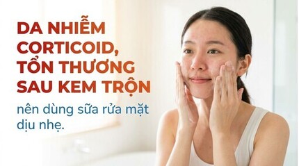 Da nhiễm corticoid, tổn thương sau kem trộn: dùng sữa rửa mặt dịu nhẹ