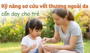 Kỹ năng sơ cứu vết thương ngoài da cần dạy cho trẻ