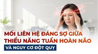 Mối liên hệ đáng sợ giữa thiểu năng tuần hoàn não và nguy cơ đột quỵ