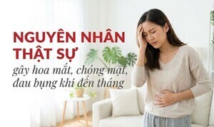 Nguyên nhân thật sự gây hoa mắt, chóng mặt, đau bụng khi đến tháng