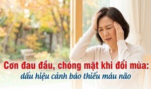 Cơn đau đầu, chóng mặt khi đổi mùa: dấu hiệu cảnh báo thiếu máu não