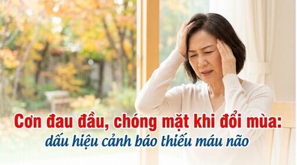 Cơn đau đầu, chóng mặt khi đổi mùa: dấu hiệu cảnh báo thiếu máu não