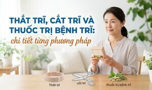Thắt trĩ, cắt trĩ và thuốc trị bệnh trĩ: chi tiết từng phương pháp