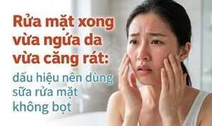 Rửa mặt xong vừa ngứa da vừa căng rát: nên dùng sữa rửa mặt không bọt