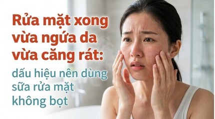 Rửa mặt xong vừa ngứa da vừa căng rát: nên dùng sữa rửa mặt không bọt